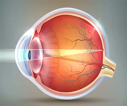 Diagram of Emmetropia in the inner-eye